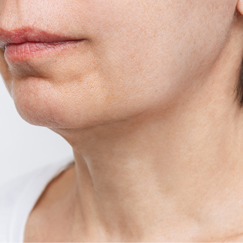 locação de equipamentos de clinica de estetica Bacacheri, Curitiba